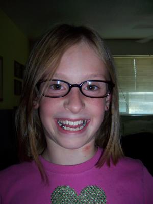 Audrey's New Glasses and blog about Savannah in ER